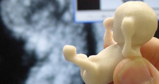 Foetus imprimé en 3D