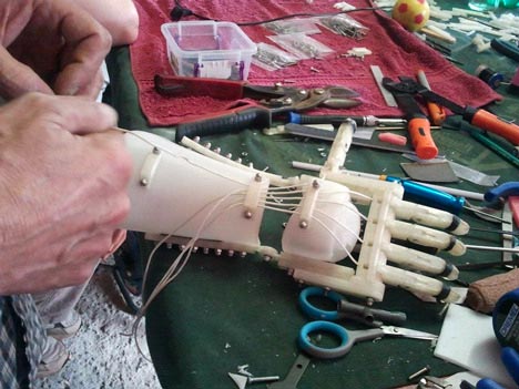 robohand greffe doigts main imprimante 3D