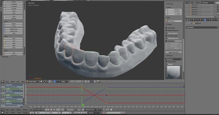 appareil dentaire 3D