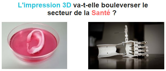 santé médical impression 3D