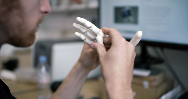 prothese main enfant imprimée en 3D