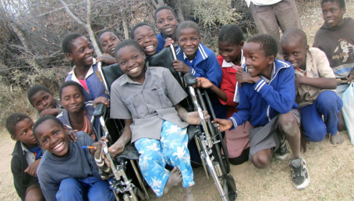 photo prothese main pied enfant Zimbabwe