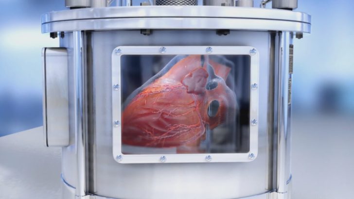 coeur imprimé en 3D