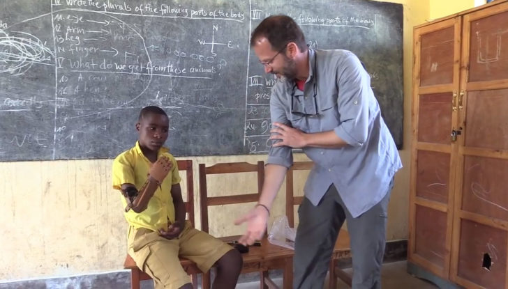 3D prothese bras rwanda