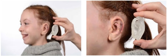 imprimer 3D oreille