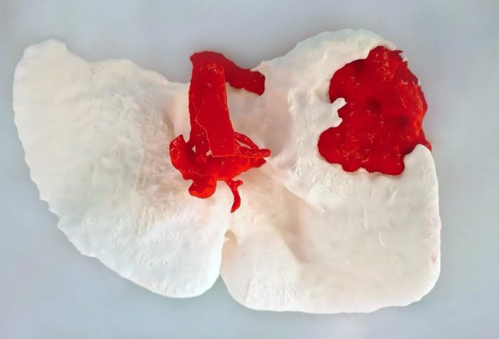impression 3D os organe tissu medical chirurgie 3D