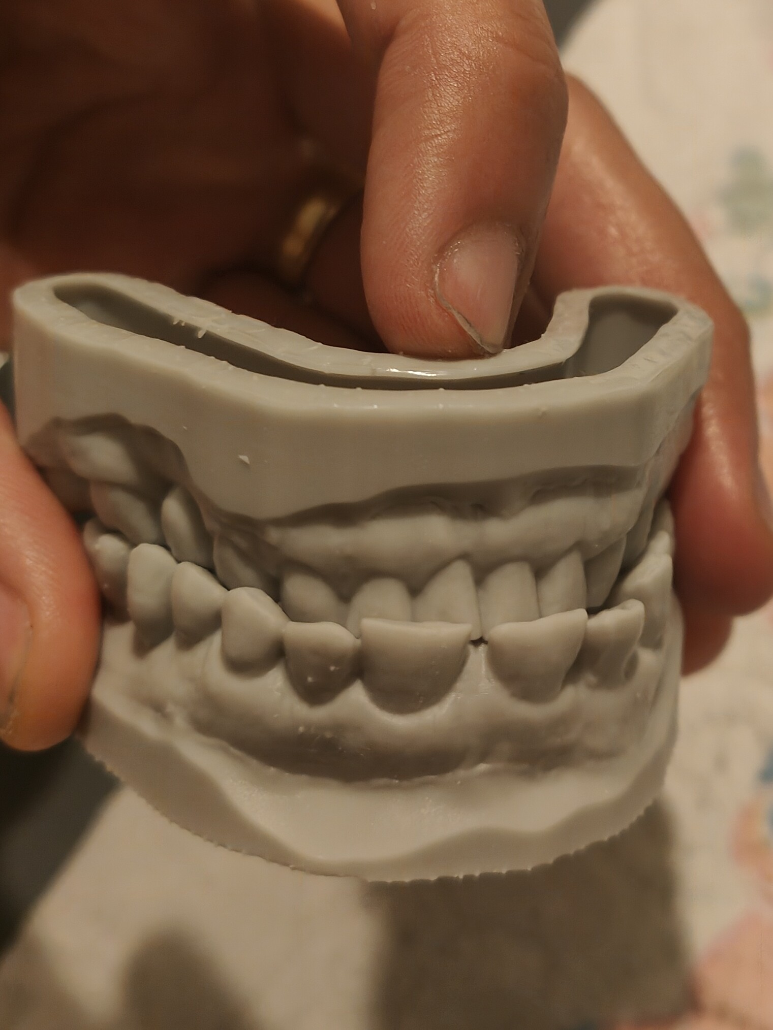 impression 3D dents machoire Elegoo Saturn 3 Ultra