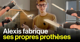 modéliser et imprimer ses propres prothèses