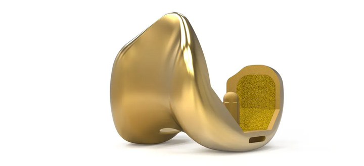 Stryker implant orthopedique